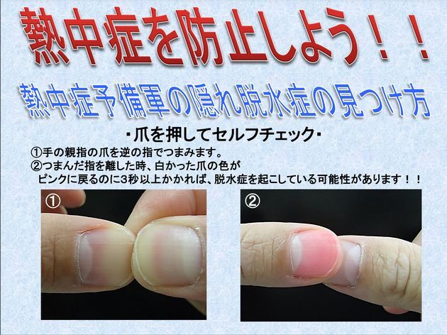 熱中症